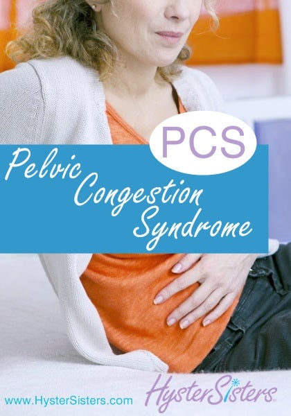 Pelvic Congestion Syndrome  What Is Pelvic Congestion Syndrome?